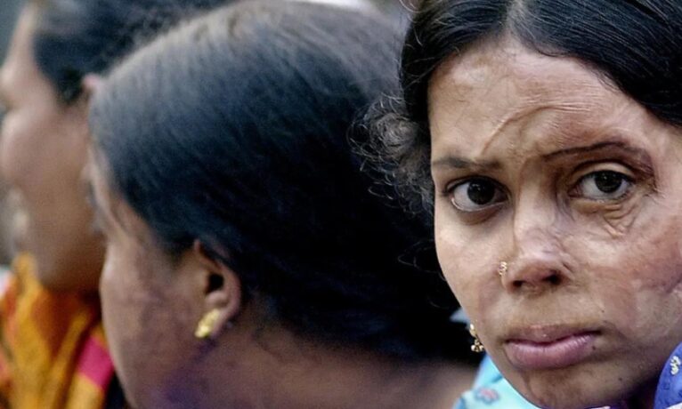 Kadınlara saldırılar artınca Hindistan’da “asit yasaklansın” kampanyası başlatıldı