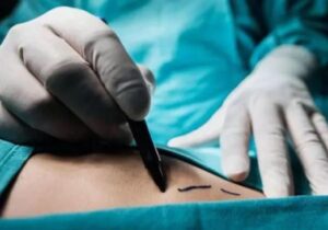 Yasadışı organ ticareti durdurulamıyor