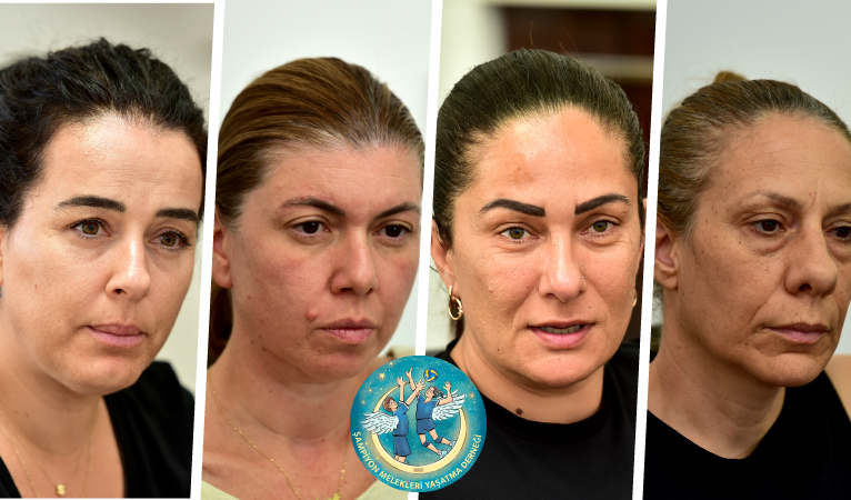 Şampiyon Melekleri Yaşatma Derneği’nden destek çağrısı yapıldı
