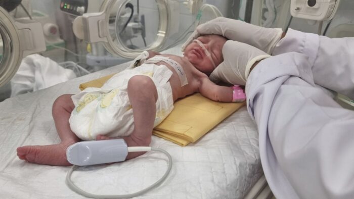 Gazze’de İsrail saldırısında ölen annenin karnındaki bebek kurtarıldı
