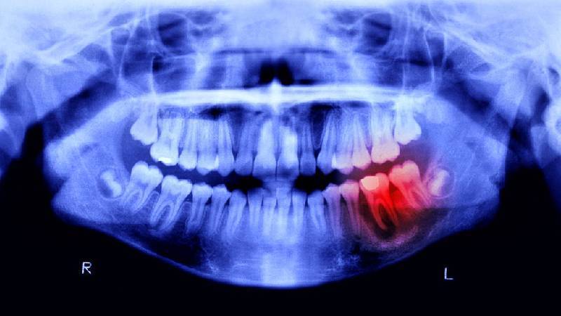 Diş mucizesi: İnsanlar yeniden diş çıkarabilecek